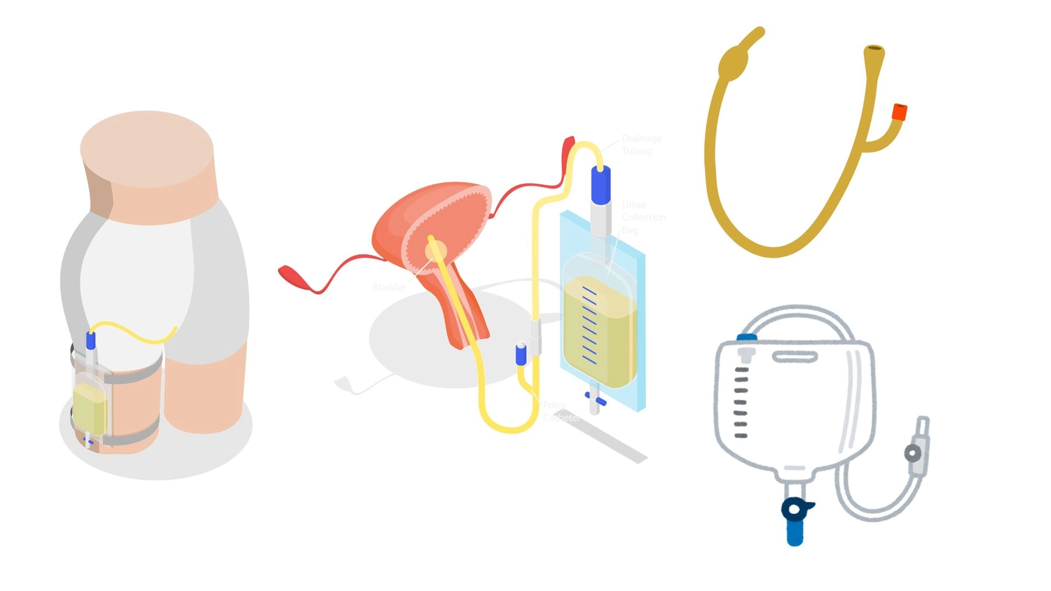 Pflegeengel Monique - Pflege mit Gefühl und Leidenschaft - Illustration, die Blasenbeutel zum Urinieren zeigt